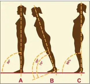 alignment